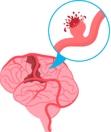 https://res.cloudinary.com/dxhgwexub/image/upload/v1747091315/wikidoctors/k8s5zegpxeibksfhcgwv.png Image