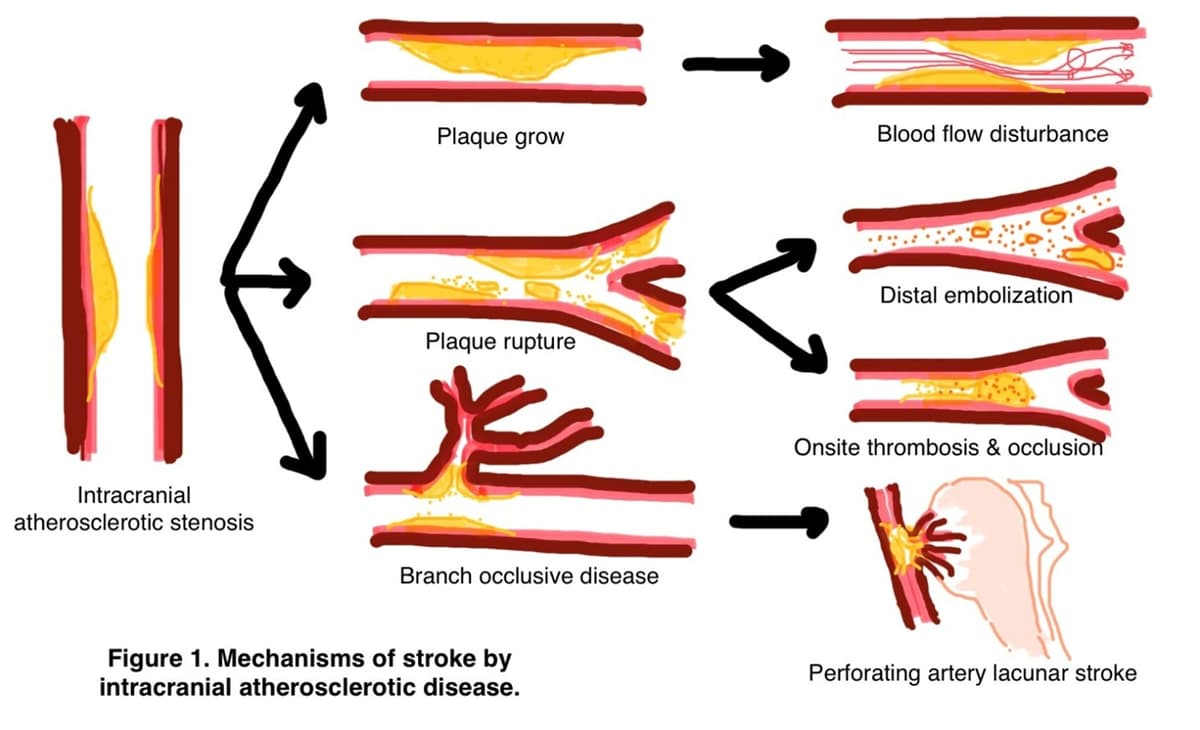 https://res.cloudinary.com/dxhgwexub/image/upload/v1747810780/wikidoctors/rxcp5cdhrpnt5bcyyatj.jpg Image